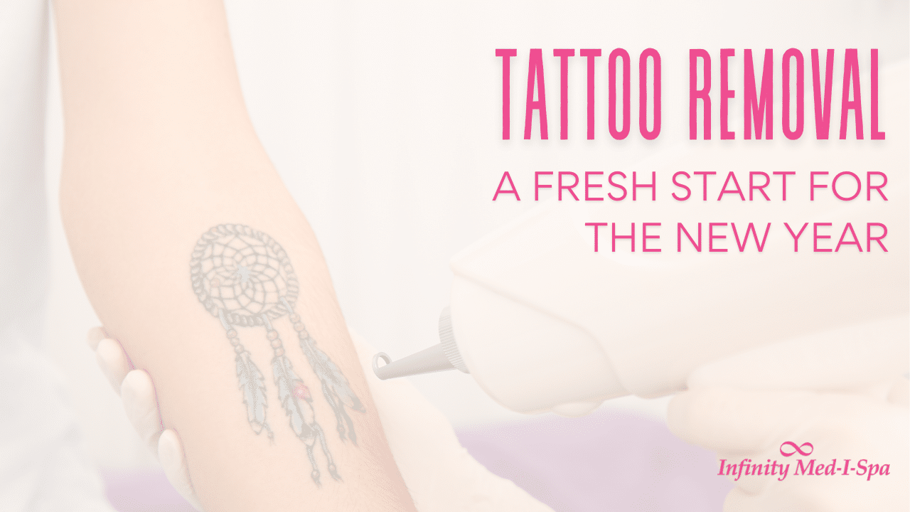 Tattoo Removal: A Fresh Start for the New Year