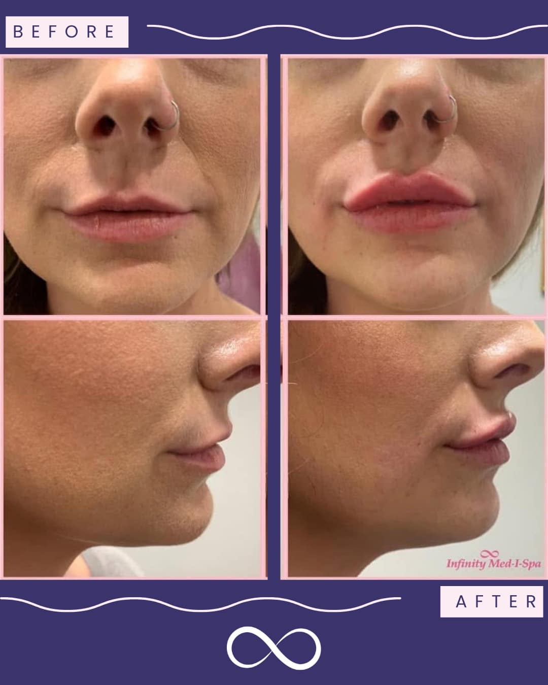 what does epithalon do Epithalon Peptide Therapy: An Overview